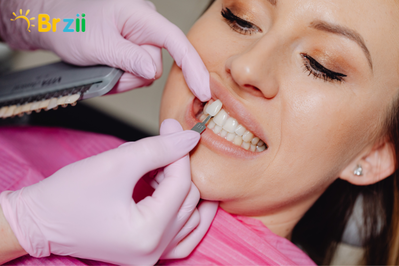 Địa chỉ dán sứ veneer tại An khánh uy tín, chất lượng trên thị trường